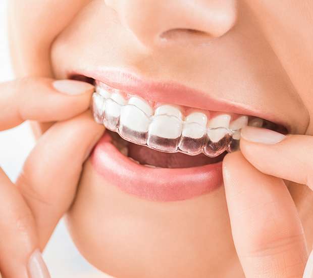 Fort Myers Does Invisalign Really Work