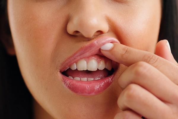 Gingivitis Treatment Options That Actually Work