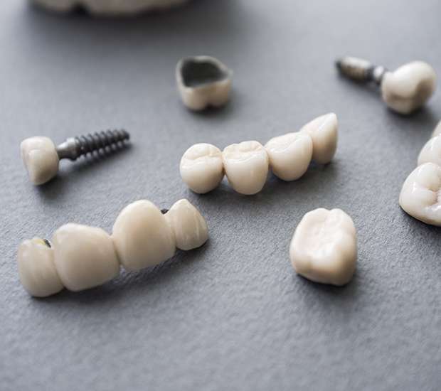 Fort Myers The Difference Between Dental Implants and Mini Dental Implants